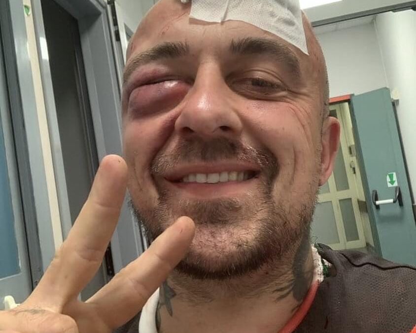 “Massacrato da sei sgherri della mafia sionista”. L’accusa di Chef Rubio sui social dopo l’aggressione