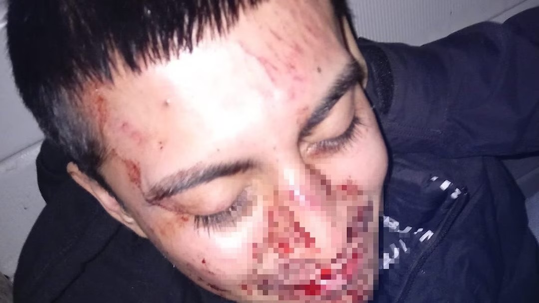 Aggressione omofoba, il consigliere di Roma Capitale Ferraro: “Il diritto di amare soffochi l’odio”