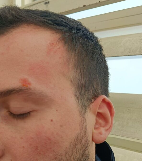 Rimesso in libertà aggredisce di nuovo i poliziotti. Fsp: “Nostra incolumità va presa sul serio”